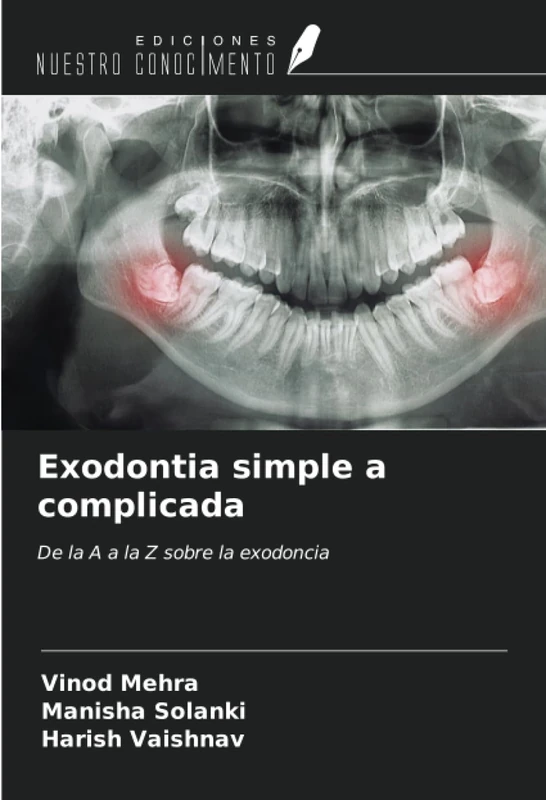 Exodontia simple a complicada: De la A a la Z sobre la exodoncia