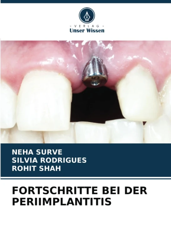 FORTSCHRITTE BEI DER PERIIMPLANTITIS