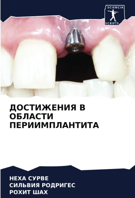 ДОСТИЖЕНИЯ В ОБЛАСТИ ПЕРИИМПЛАНТИТА