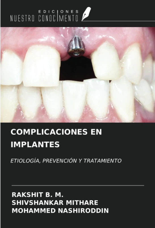 COMPLICACIONES EN IMPLANTES: ETIOLOGÍA, PREVENCIÓN Y TRATAMIENTO