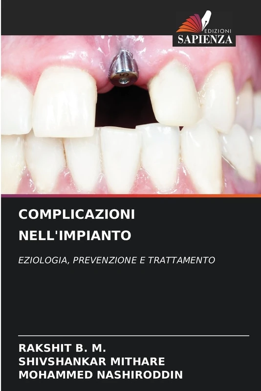 COMPLICAZIONI NELL'IMPIANTO: EZIOLOGIA, PREVENZIONE E TRATTAMENTO