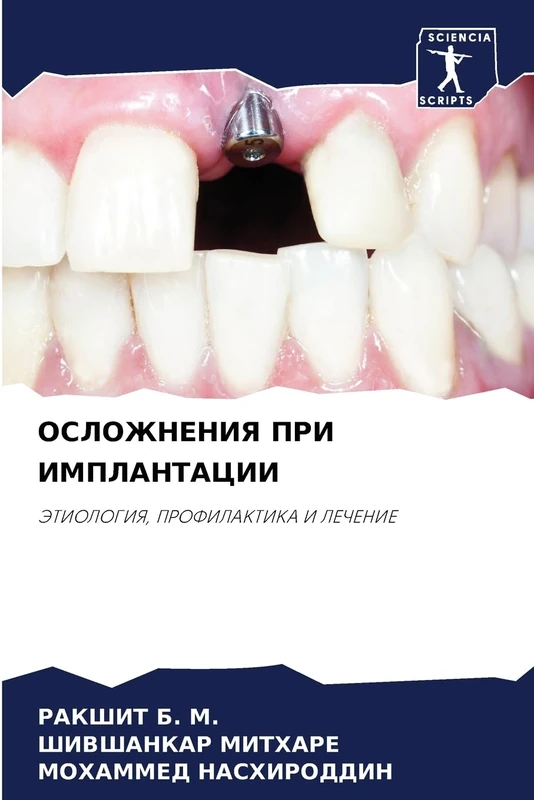 ОСЛОЖНЕНИЯ ПРИ ИМПЛАНТАЦИИ: ЭТИОЛОГИЯ, ПРОФИЛАКТИКА И ЛЕЧЕНИЕ: JeTIOLOGIYa, PROFILAKTIKA I LEChENIE