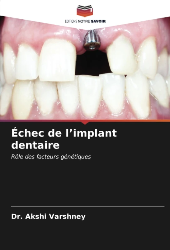 Échec de l’implant dentaire: Rôle des facteurs génétiques