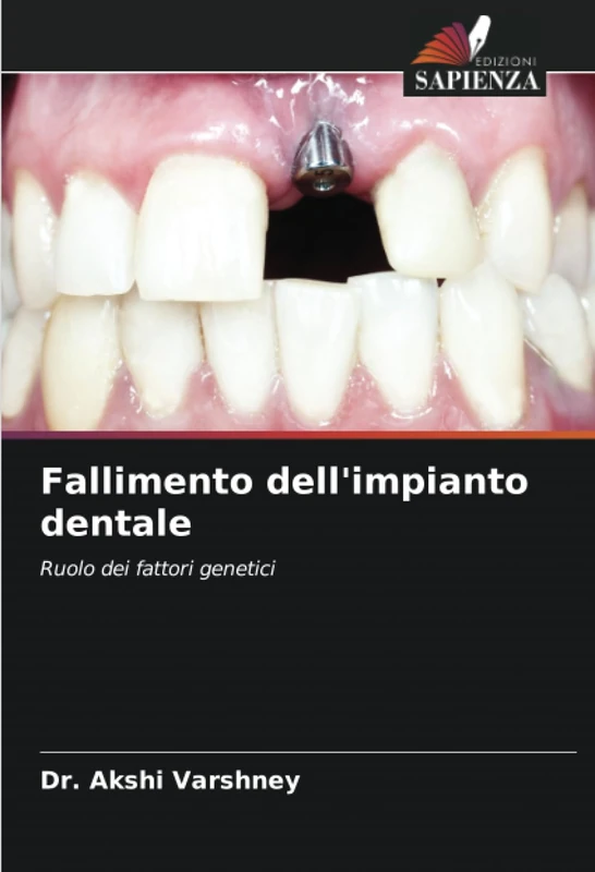 Fallimento dell'impianto dentale: Ruolo dei fattori genetici