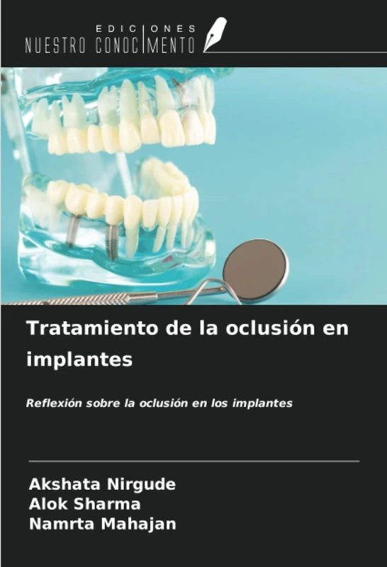 Tratamiento de la oclusión en implantes: Reflexión sobre la oclusión en los implantes