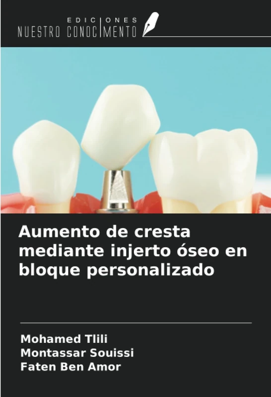Aumento de cresta mediante injerto óseo en bloque personalizado