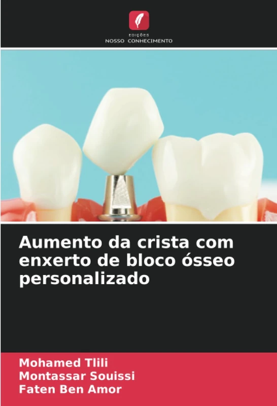 Aumento da crista com enxerto de bloco ósseo personalizado