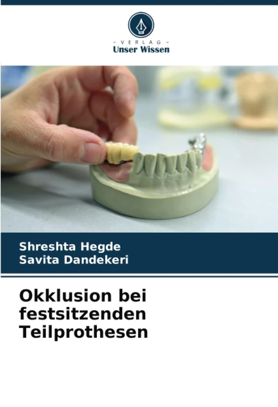 Okklusion bei festsitzenden Teilprothesen