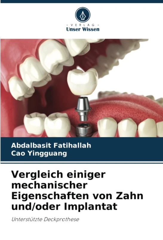 Vergleich einiger mechanischer Eigenschaften von Zahn und/oder Implantat: Unterstützte Deckprothese