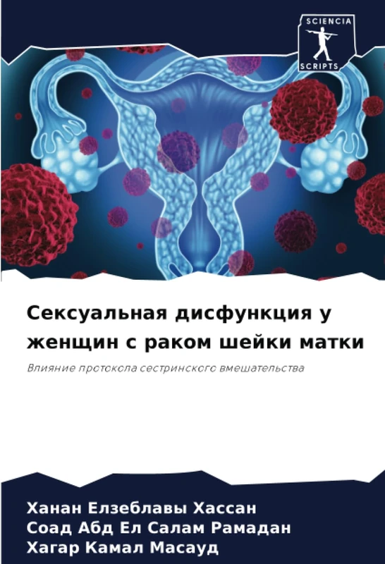 Сексуальная дисфункция у женщин с раком шейки матки: Влияние протокола сестринского вмешательства: Vliqnie protokola sestrinskogo wmeshatel'stwa