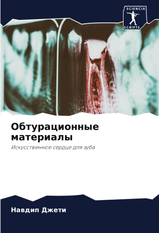 Обтурационные материалы: Искусственное сердце для зуба: Iskusstwennoe serdce dlq zuba