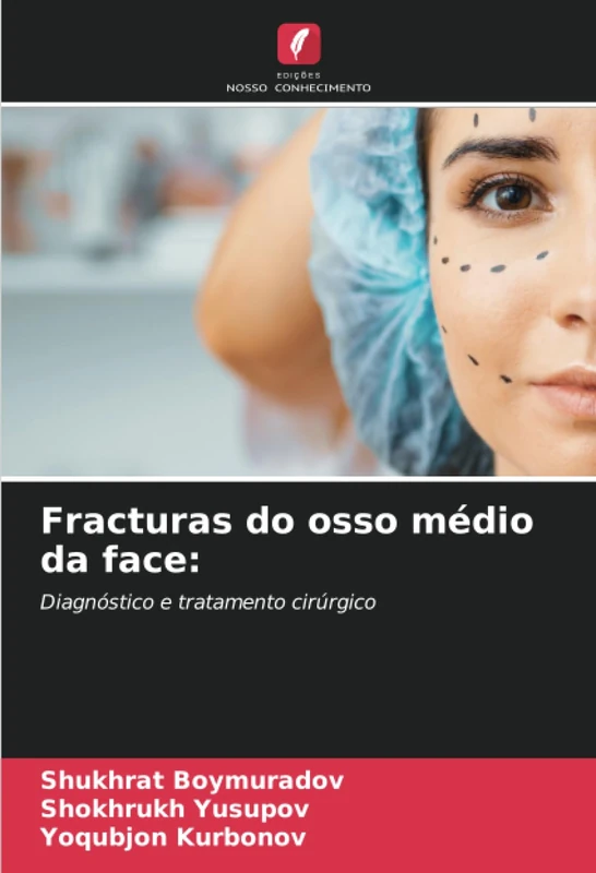 Fracturas do osso médio da face:: Diagnóstico e tratamento cirúrgico