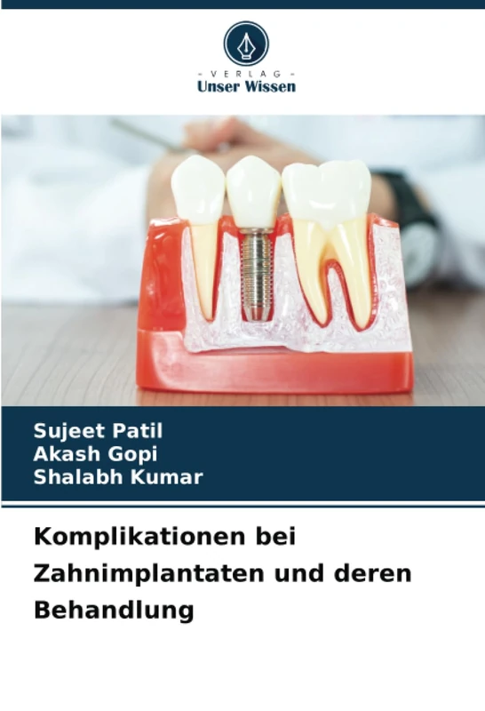 Komplikationen bei Zahnimplantaten und deren Behandlung