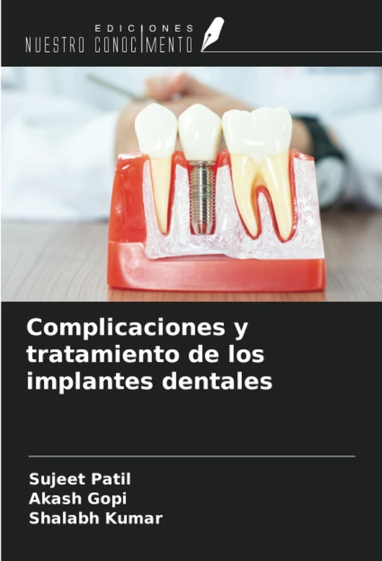 Complicaciones y tratamiento de los implantes dentales