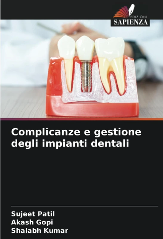 Complicanze e gestione degli impianti dentali