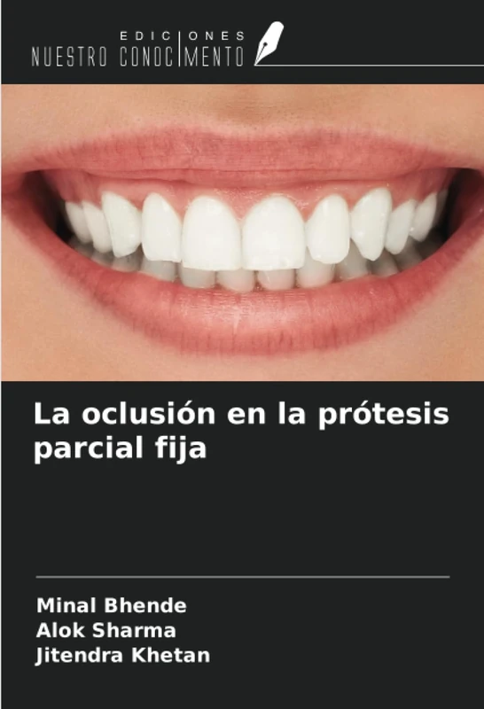 La oclusión en la prótesis parcial fija