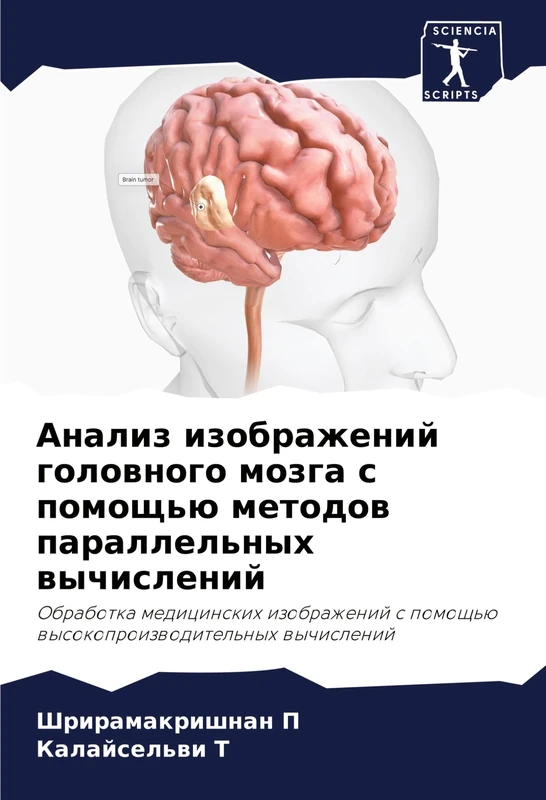 Анализ изображений головного мозга с помо: Obrabotka medicinskih izobrazhenij s pomosch'ü wysokoproizwoditel'nyh wychislenij