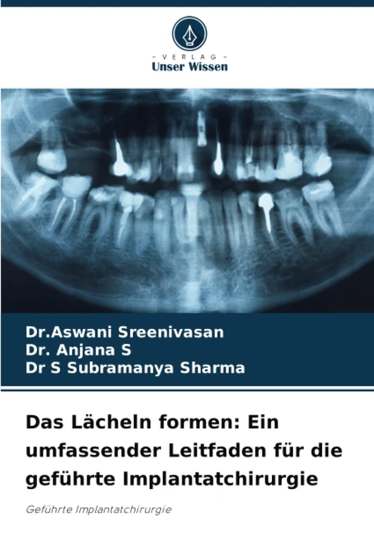 Das Lächeln formen: Ein umfassender Leitfaden für die geführte Implantatchirurgie: Geführte Implantatchirurgie - Image 1