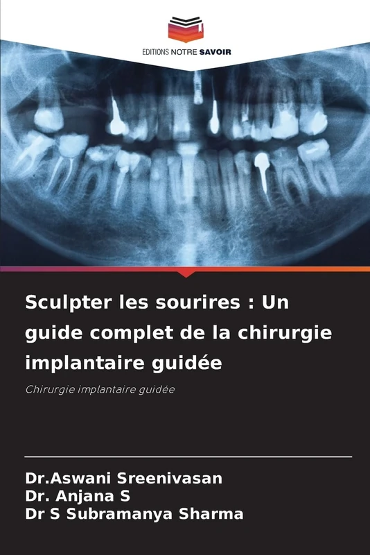 Sculpter les sourires : Un guide complet de la chirurgie implantaire guidée: Chirurgie implantaire guidée