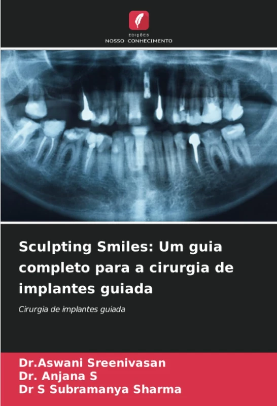Sculpting Smiles: Um guia completo para a cirurgia de implantes guiada: Cirurgia de implantes guiada