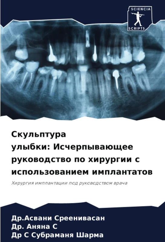 Скульптура улыбки: Исчерпывающее руководство по хирургии с использованием имплантатов: Хирургия имплантации под руководством врача