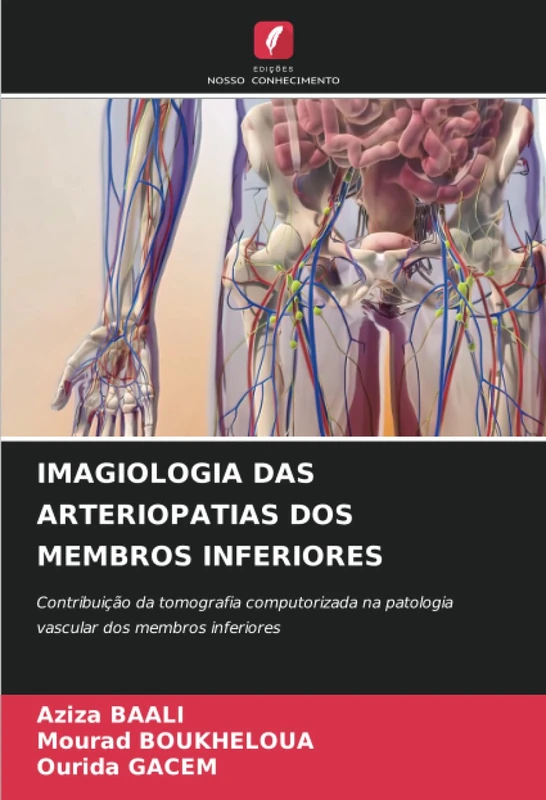 IMAGIOLOGIA DAS ARTERIOPATIAS DOS MEMBROS INFERIORES: Contribuição da tomografia computorizada na patologia vascular dos membros inferiores - Image 1