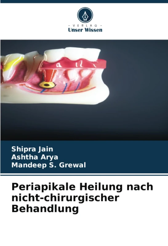 Periapikale Heilung nach nicht-chirurgischer Behandlung
