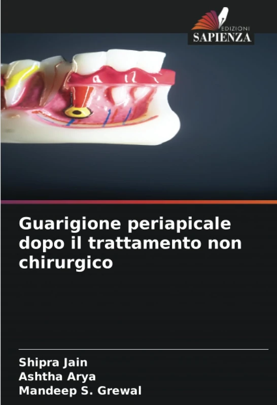 Guarigione periapicale dopo il trattamento non chirurgico