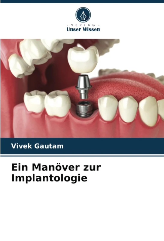 Ein Manöver zur Implantologie
