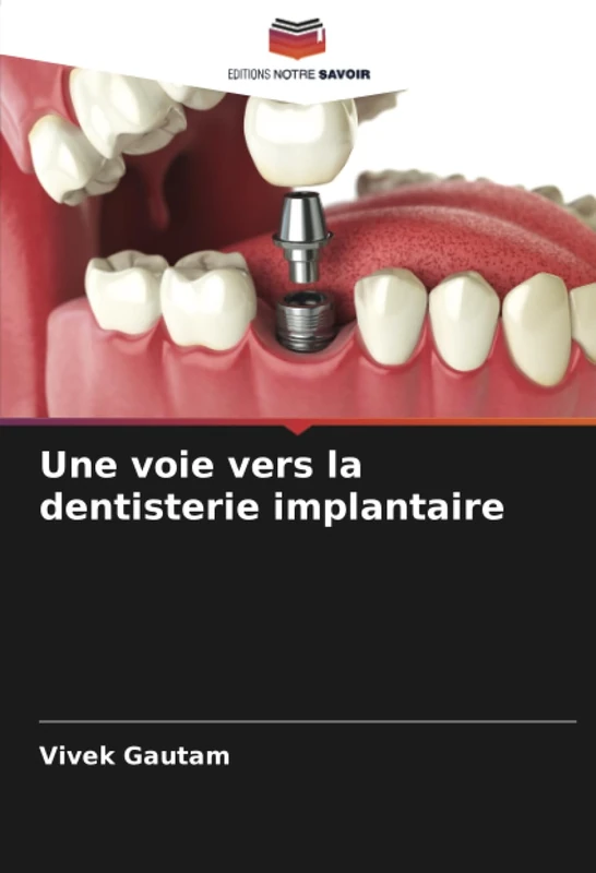 Une voie vers la dentisterie implantaire