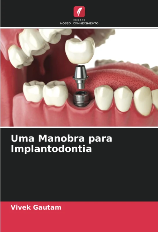 Uma Manobra para Implantodontia