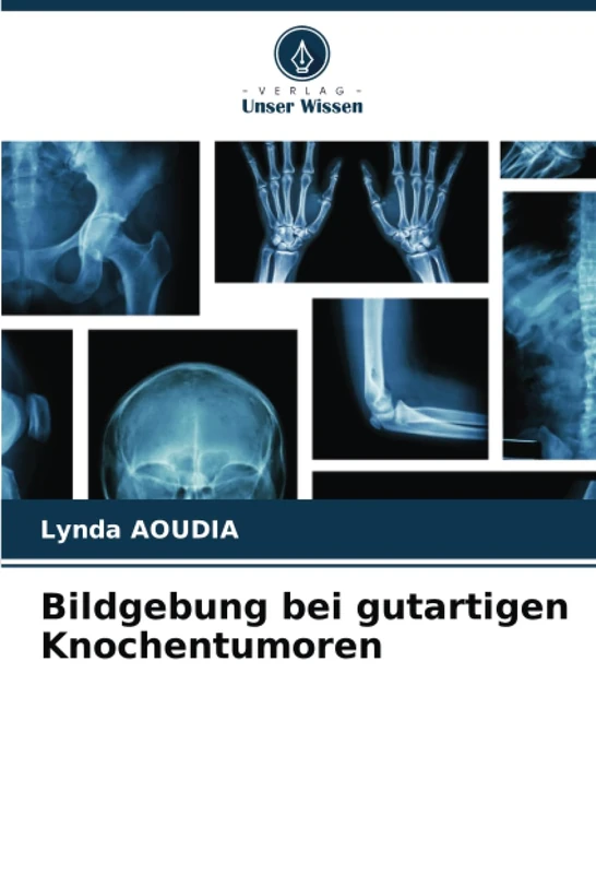 Bildgebung bei gutartigen Knochentumoren