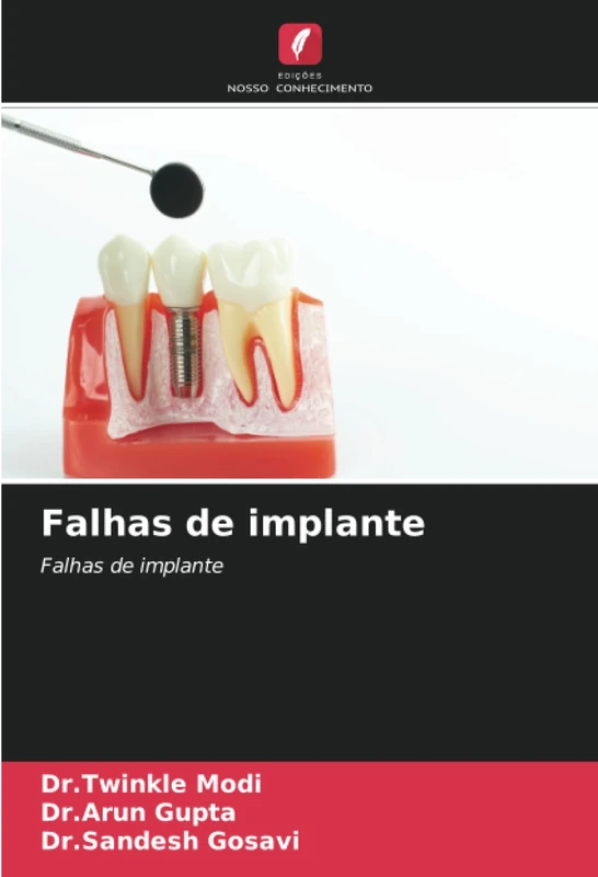 Falhas de implante: Falhas de implante
