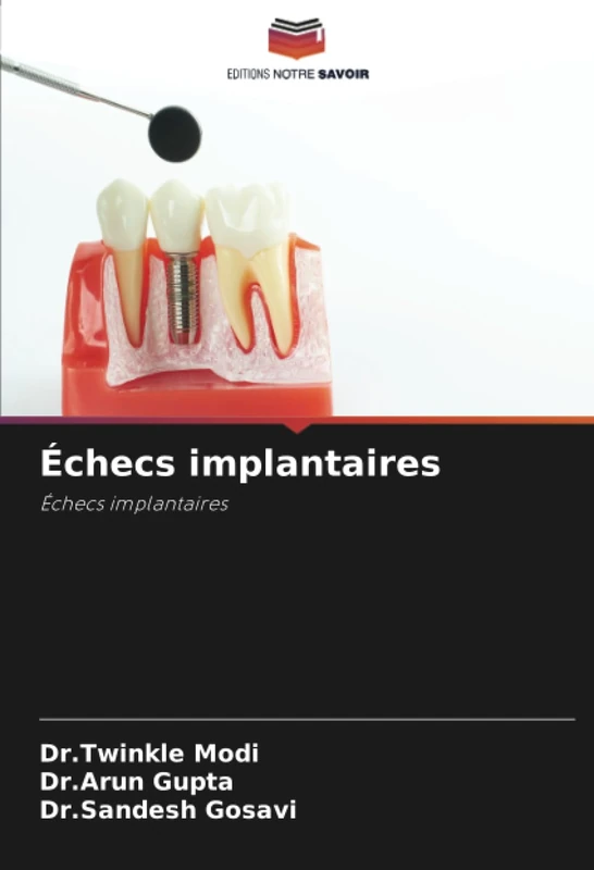 Échecs implantaires: Échecs implantaires