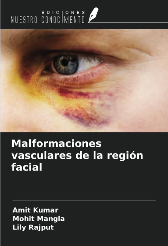 Malformaciones vasculares de la región facial