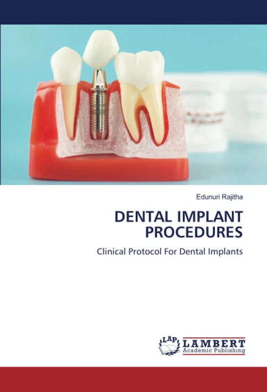 DENTAL IMPLANT PROCEDURES: Clinical Protocol For Dental Implants