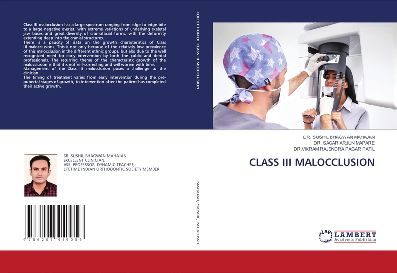 CLASS III MALOCCLUSION