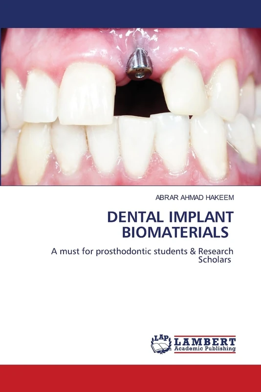 DENTAL IMPLANT BIOMATERIALS: A must for prosthodontic students & Research Scholars