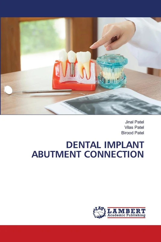 DENTAL IMPLANT ABUTMENT CONNECTION - Image 1