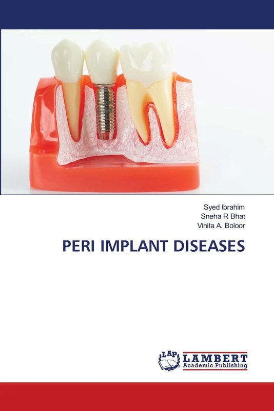 PERI IMPLANT DISEASES