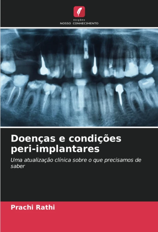 Doenças e condições peri-implantares: Uma atualização clínica sobre o que precisamos de saber