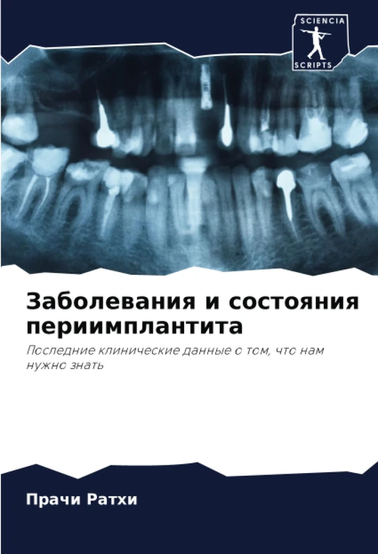 Заболевания и состояния периимплантита: Последние клинические данные о том, что нам нужно знать: Poslednie klinicheskie dannye o tom, chto nam nuzhno znat'