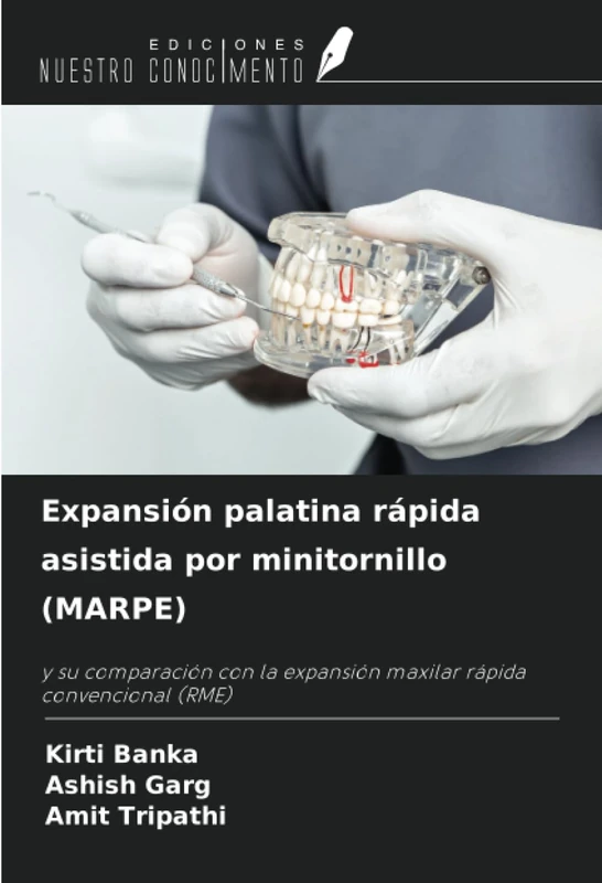 Expansión palatina rápida asistida por minitornillo (MARPE): y su comparación con la expansión maxilar rápida convencional (RME) - Image 1