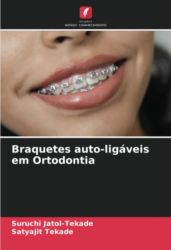 Braquetes auto-ligáveis em Ortodontia