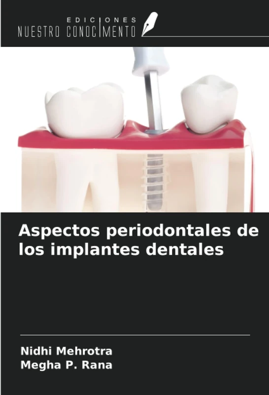 Aspectos periodontales de los implantes dentales