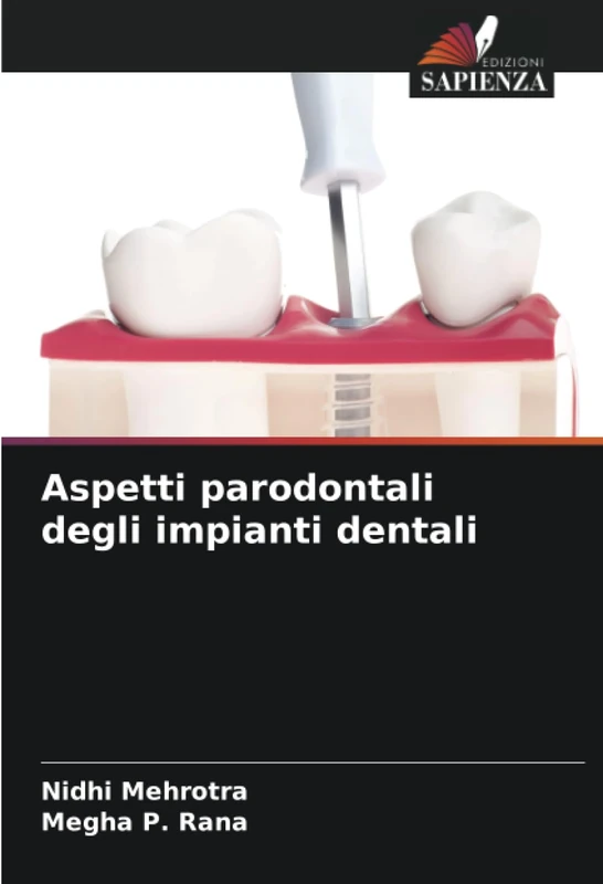 Aspetti parodontali degli impianti dentali