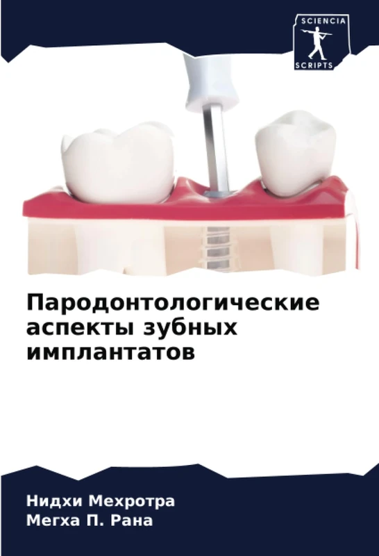 Пародонтологические аспекты зубных имплантатов