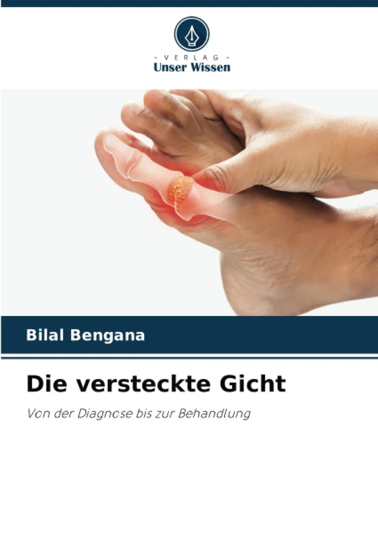 Die versteckte Gicht: Von der Diagnose bis zur Behandlung - Image 1