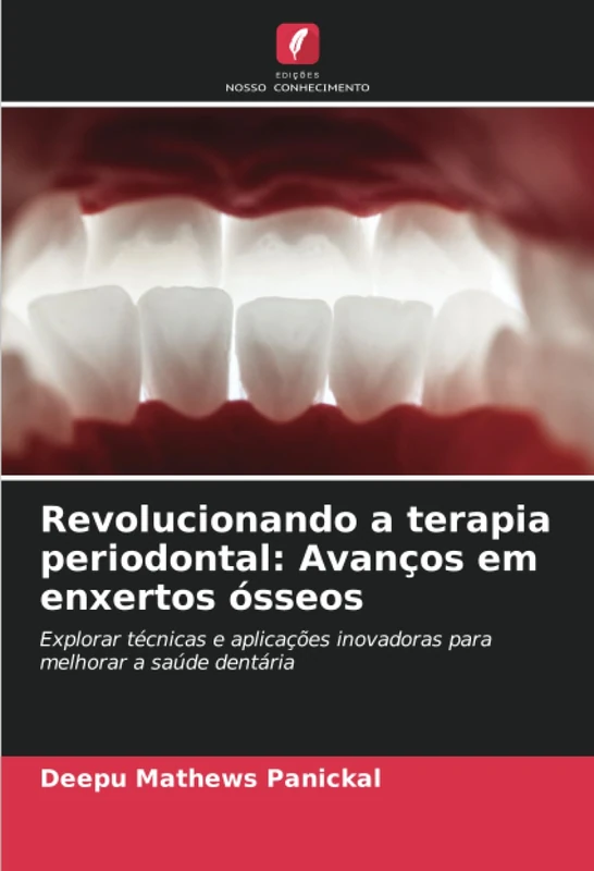Revolucionando a terapia periodontal: Avanços em enxertos ósseos: Explorar técnicas e aplicações inovadoras para melhorar a saúde dentária - Image 1