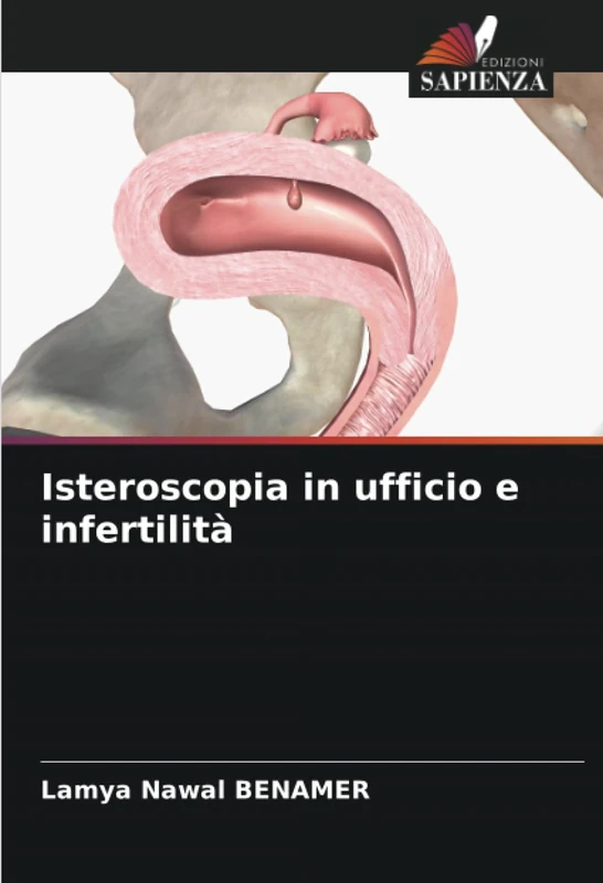 Isteroscopia in ufficio e infertilità